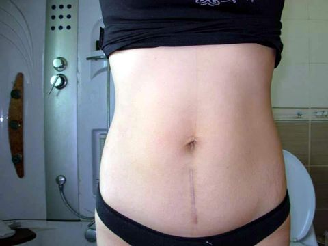 Ů���ʸ�����Ķ�Ƥ �Ҳ��̶�